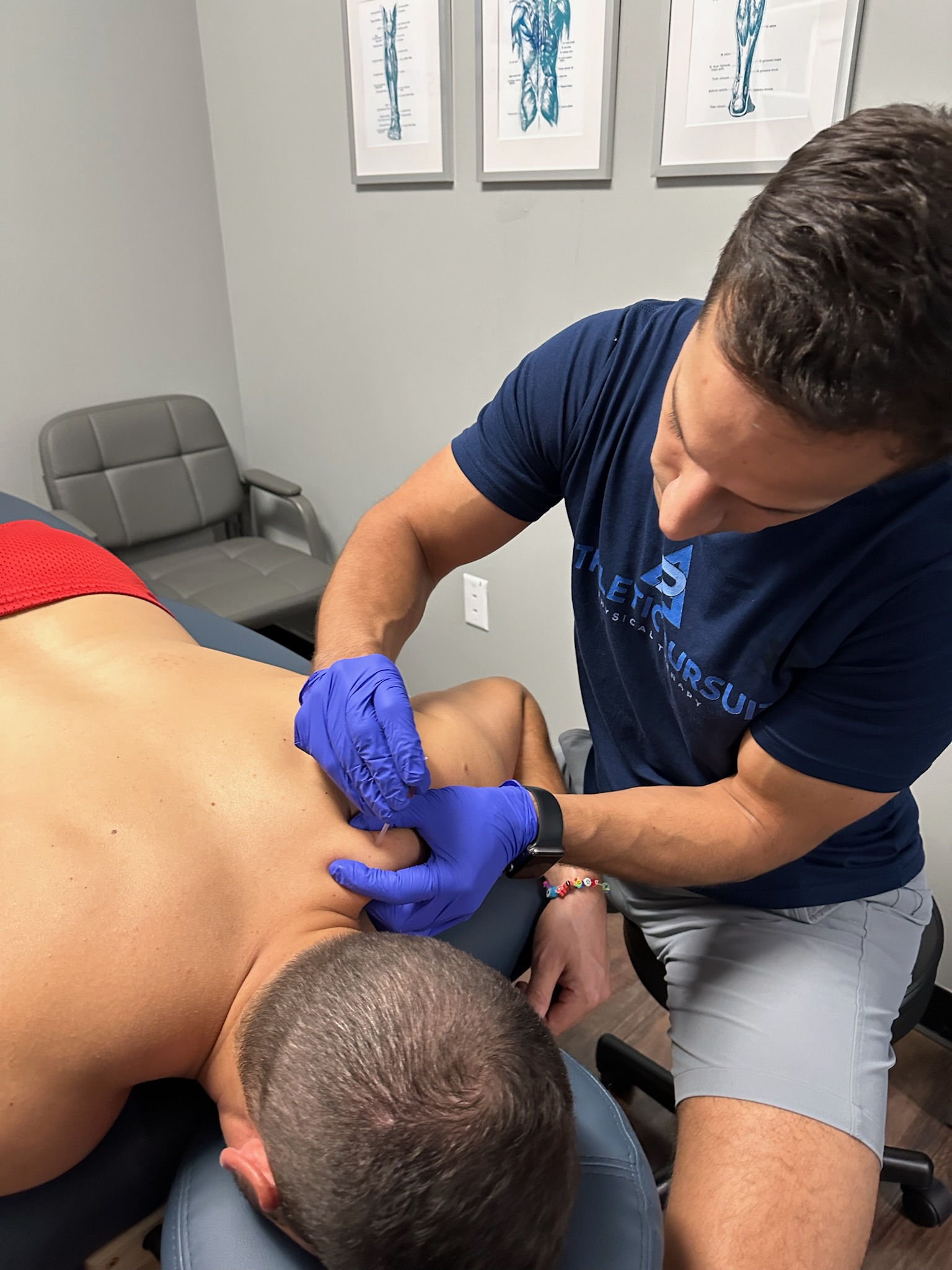 Physical Therapist dry needling patient's shoulder